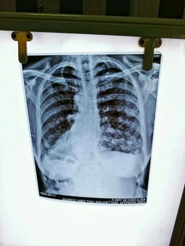 Agfa Structurix F8 NIF