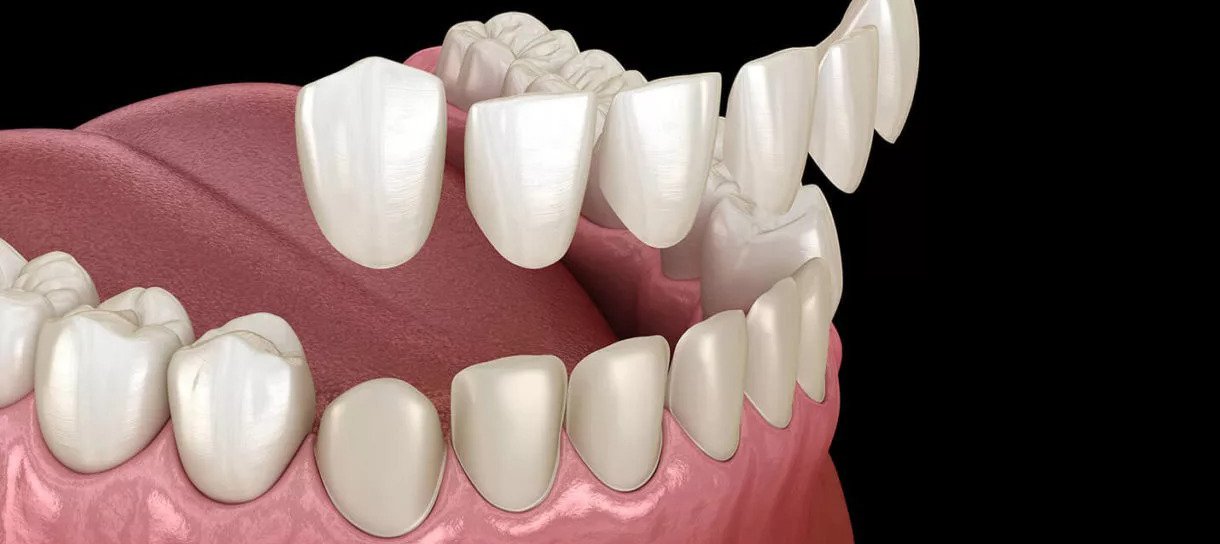 3Shape Trios Dental Acquisition