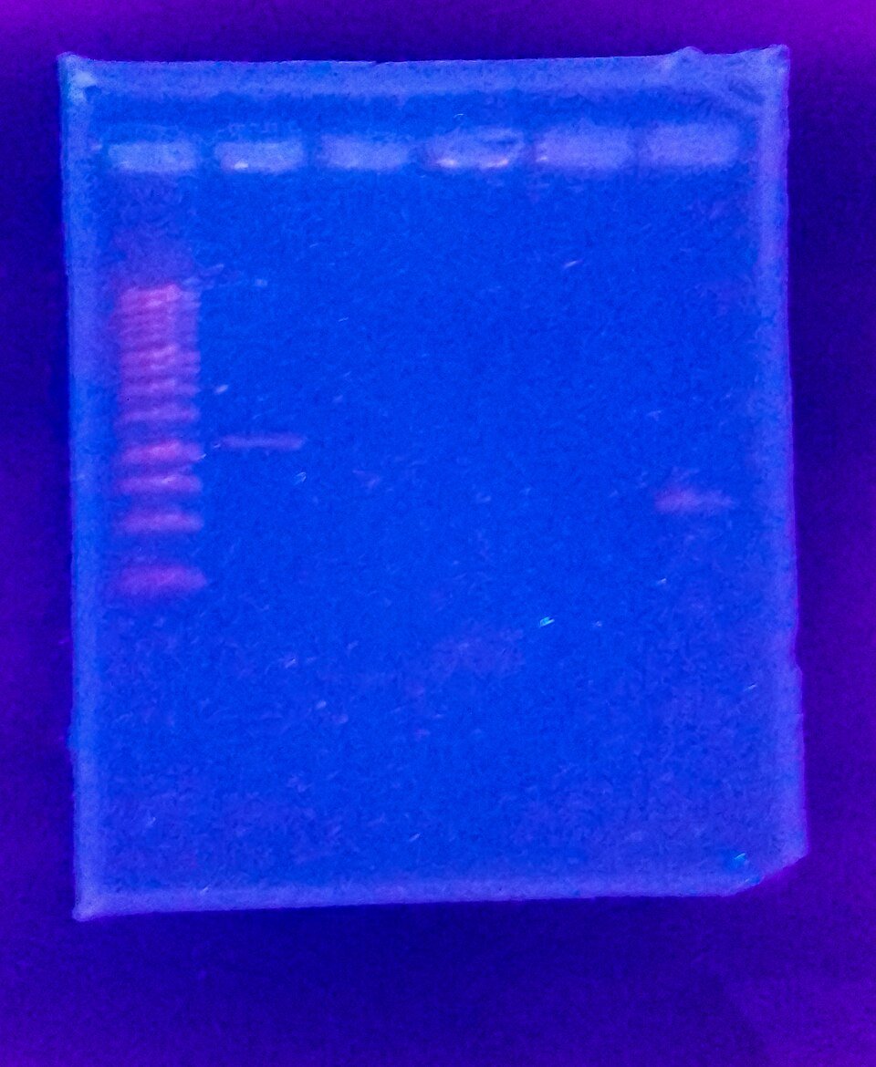 RT PCR
