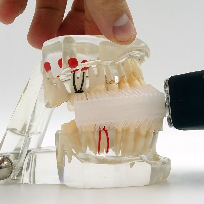 Dental Implant