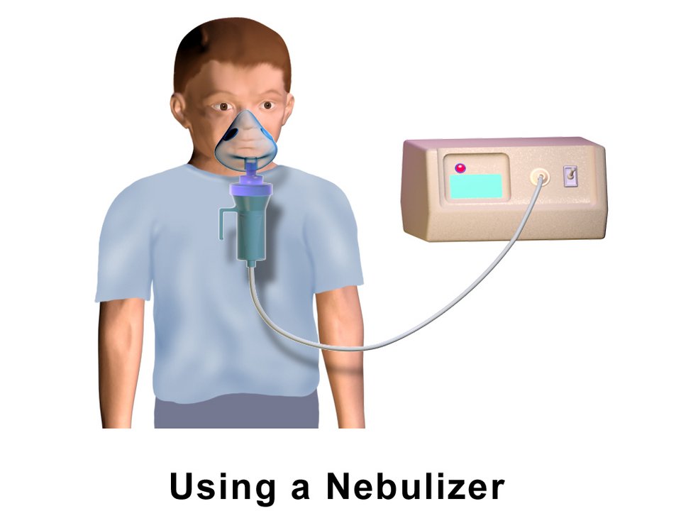 Nubulizers, Wholesale Nebulizers, Buy Nebulizers