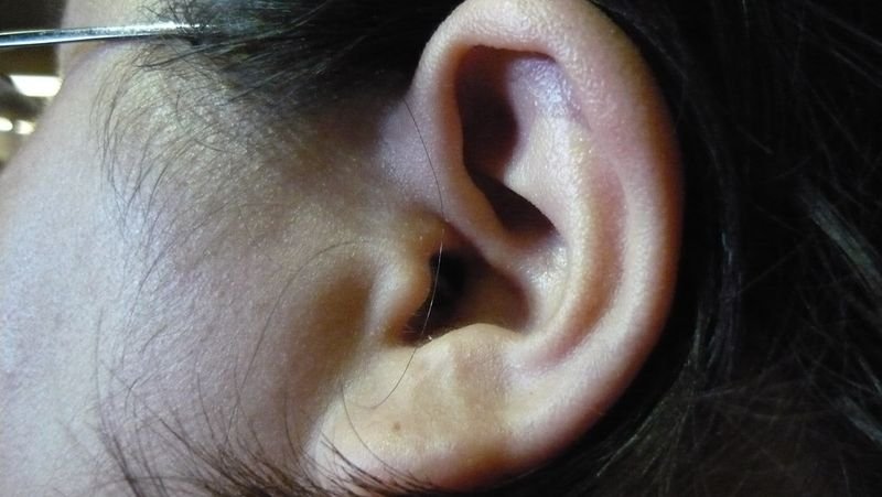 Ear pod